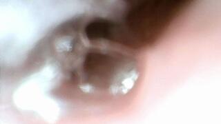 cherry tomatos endo stomach cam