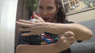 Veins on my arms and legs hl