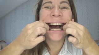 Look at my mouth and teeth so close