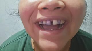 fat girl shows her ugly and disgusting teeth
