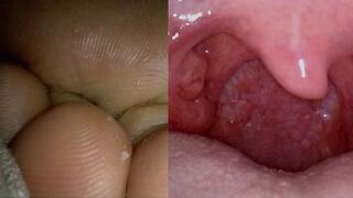 An Exploration Too Far