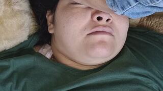 My friend steps on my fat face.