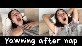 Yawning after a long nap!
