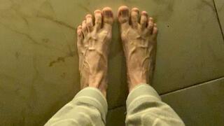 Swollen veins on the feet