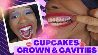 Cupcake's Crown & Cavities: MODDED MOUTH TOUR IN 4K