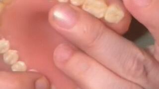 I GOT A NEW FULL SET OF DENTURES watch and listen