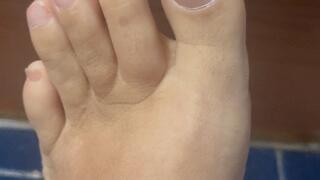 Wrinkles on bare heels and feet.