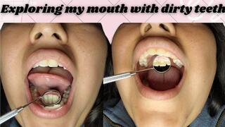 Examining my big mouth with a dentist's mirror