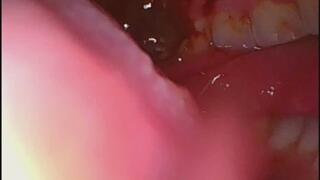 Borescope inside chewing biting teeth at work