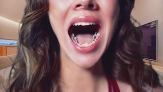 Girlfriend Reveals Fillings