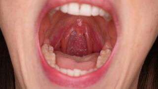 Welcome to my throat