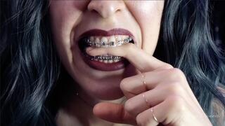 Biting my own fingers - bite, mouth, teeth, braces, fetish ITA