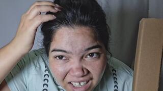 blow after blow to the head