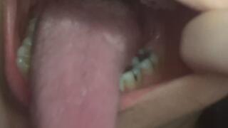 a close personal tour of my mouth