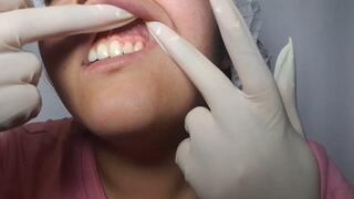 Morning check for yellow teeth