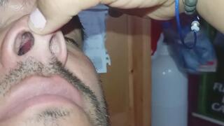 Detalles íntimos de su nariz: formas, pelitos y interior.