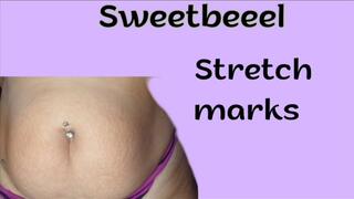 "My most intimate stretch marks: I'll show you every mark on my belly and my juicy breasts"