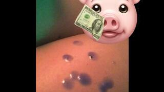 HOTS CANDLE DRIPS BLUE WAX ON MY BODY