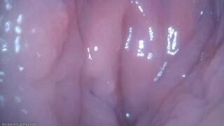 bladder exam turns me on (720 mp4)