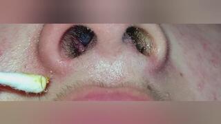 Mi nariz en primer plano, su textura y limpieza nasal.