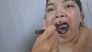 Inspection of yellow teeth