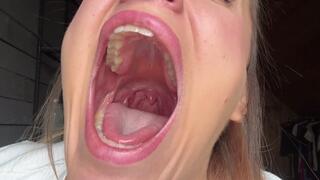 Total exhaustion, endless yawning