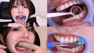 Haruna Kawai - Observing Haruna's teeth with a dental mirror & brushing her teeth while wearing a mouth opener & finger toothbrushing while wearing a lip hook - MOV 1080p