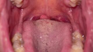 Slow and soft uvula show