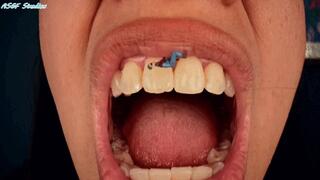 Just food stuck to her teeth! GM mouth views, tiny trapped on tongue! - MP4