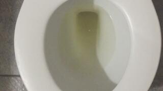 MY GOLD PEE IN MY TOILET