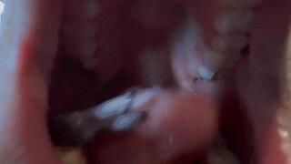 Bry Swallows Dentist- MKV