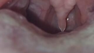 Franchesca's uvula