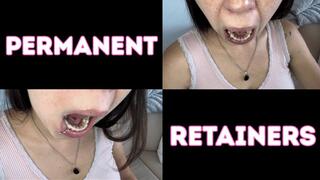 Permanent retainer sexy mouth tour