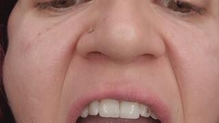 A detailed tour of my mouth