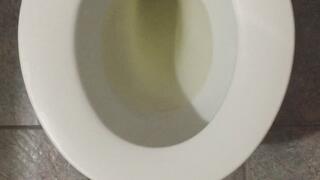 PURE GOLD PEE