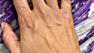 Silent Focus — Ebony Hands, Veins in the Spotlight