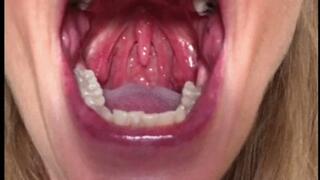 TIRED MOUTH WIDE OPEN