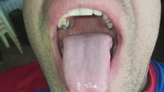 Vista completa del interior de la boca.