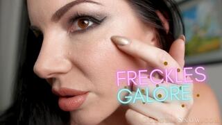 Freckles Galore