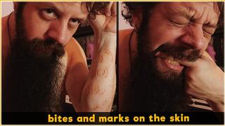 Bites and marks on the skin | Full HD 1080p | Self Biting - vore