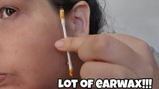 Removing Ear Wax with Q-Tips – Deep Clean Close Up