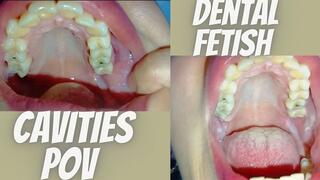 Pov. Crooked and decayed teeth