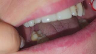 Detailed tour of the teeth and tooths from the whole mouth 8K