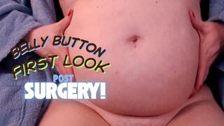 Belly Button First Look Post Surgery - MP4