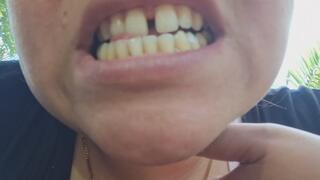 My yellow teeth dominate you