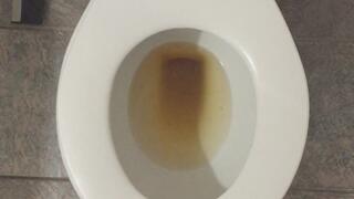 GOLDEN PEE IN TOILET PROFIT PERCENT SITTING