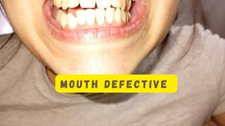 My teeth have been dirty for days.