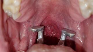 The male giant wants to swallow his two shrunken mates