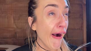 Swollen tonsils irritated by yawning wmv