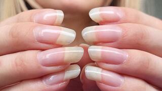 Natural, Scratchy Nails